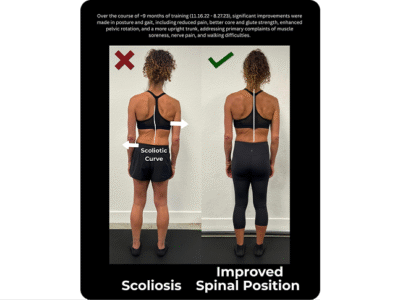 Santa Cruz Biomechanics