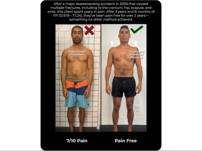 Santa Cruz Biomechanics