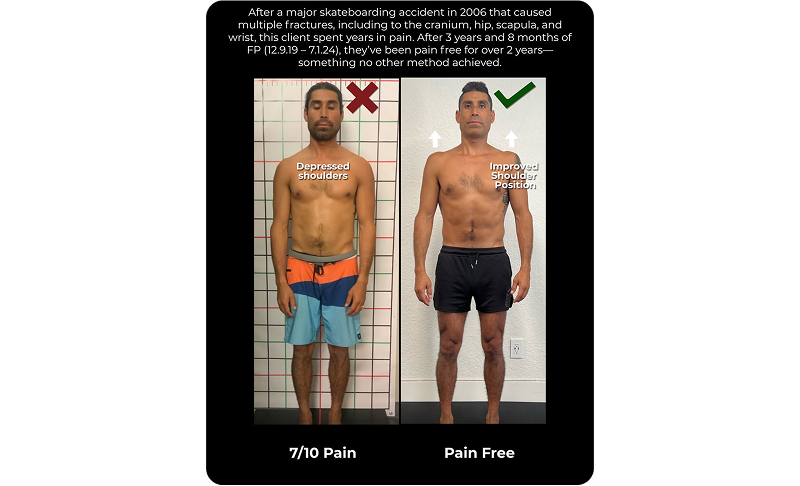 Santa Cruz Biomechanics